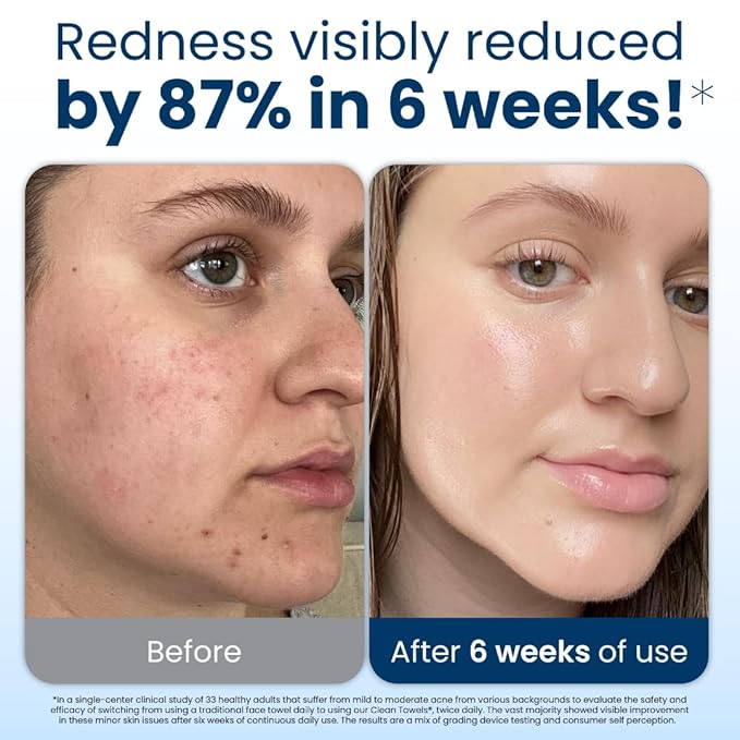 Clean Skin Club Clean Towels XL, USDA Certified 100% Biobased Dermatologist Approved Disposable Face Towelette, Facial Washcloth, Makeup Remover Dry Wipes, Ultra Soft, 150 count, 3 pack