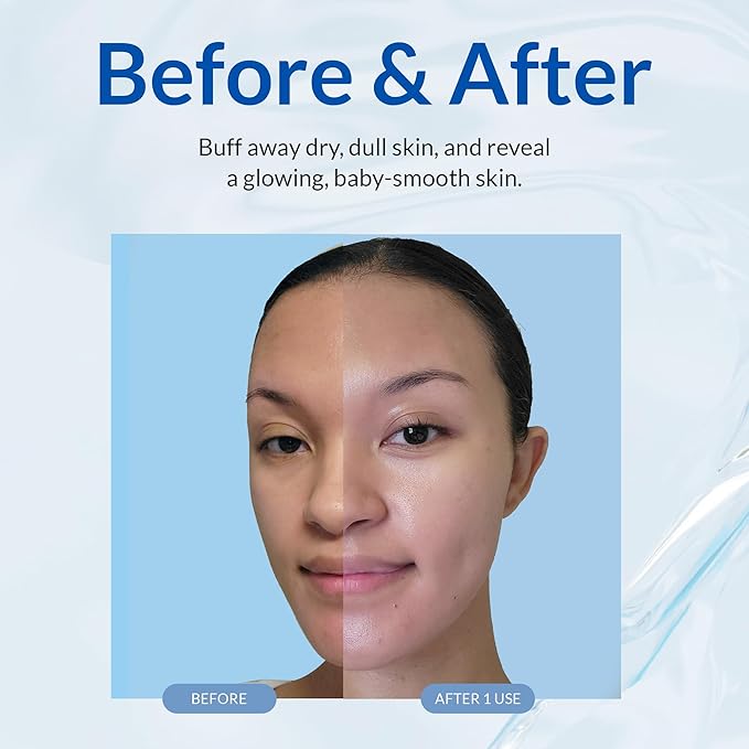 Cure by Toyo | Aqua Gel Gentle Exfoliator | Clear and Softer Skin | Non-Abrasive Face and Body Cleanser | Sensitive Skin | 3 Pack