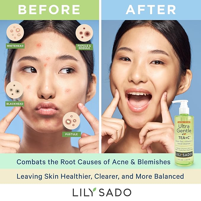LILY SADO TEA+C™ Green Tea & Vitamin C Face Cleanser – Natural Vegan Antioxidant Daily Face Wash with Aloe, Rosehip, Meadowfoam - Gentle Deep Cleansing for Acne, Blackheads, Blemishes. 8 oz