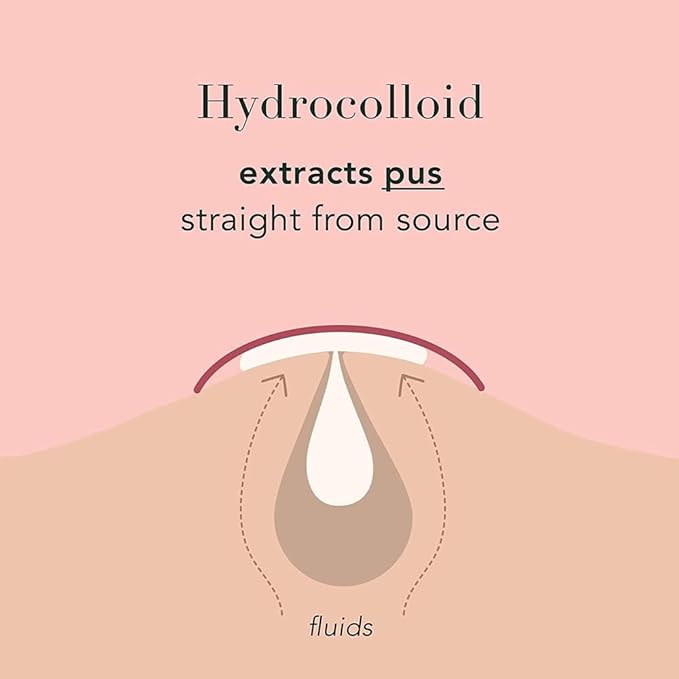 a.l.m. Magical Patch (2) Hydrocolloid pimple patches. These ultra thin & translucent hydrocolloid adhesive covers and absorb unwanted pimples. Parches Para Acne for skincare.