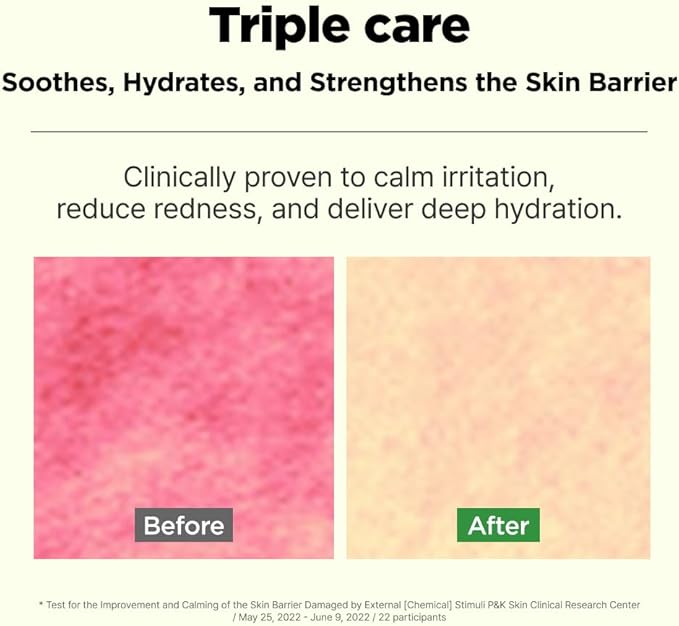 ISOI Moisture Dr. Soothing Toner, Lightweight Hydrating Toner with Tea Tree Ceramide & Hyaluronic Acid for Skin Barrier Support, Korean Skin Care (4.39 fl.oz/130ml)