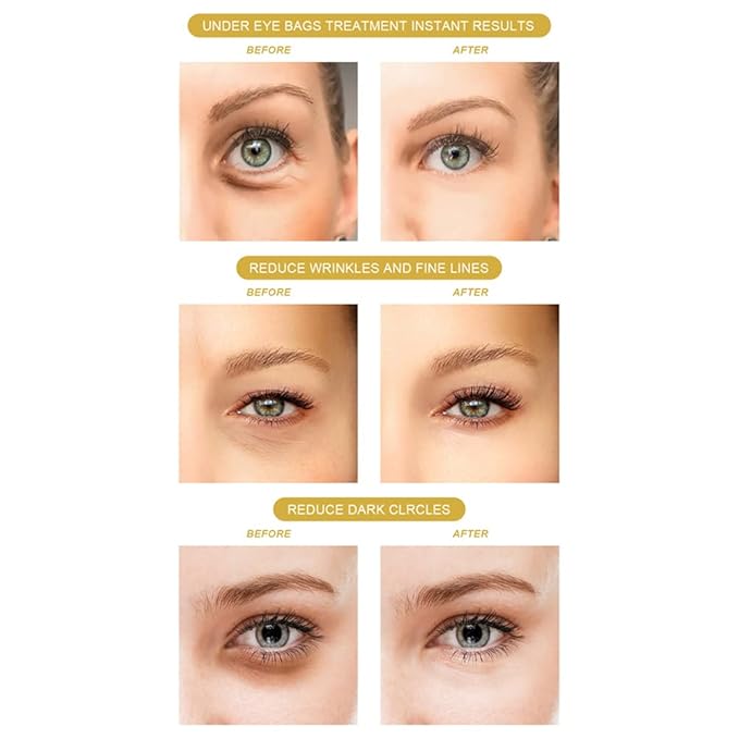 120PCS Under Eye Patches 24K Gold Eye Mask with Aloe Vera Natural Ingredients, Moisturizing Skin Care with Hyaluronic Acid and Collagen for Anti-Wrinkle, for Dark Circles and Puffiness