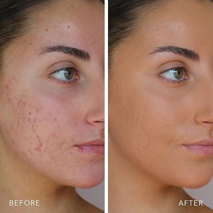 Doll 10 TCE Liquid Filter - Covers, Blurs, and Brightens (Deep)