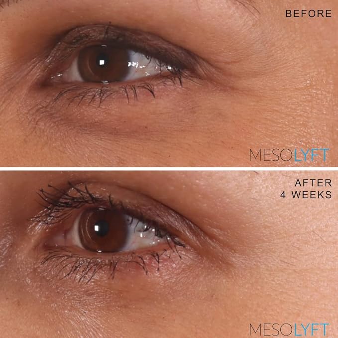 Anti-Aging Serum with Neck & Eyes Combo Skincare Face Serum Reduce Signs of Aging Roller for Face An Effective Treatment for Neck and Eyes