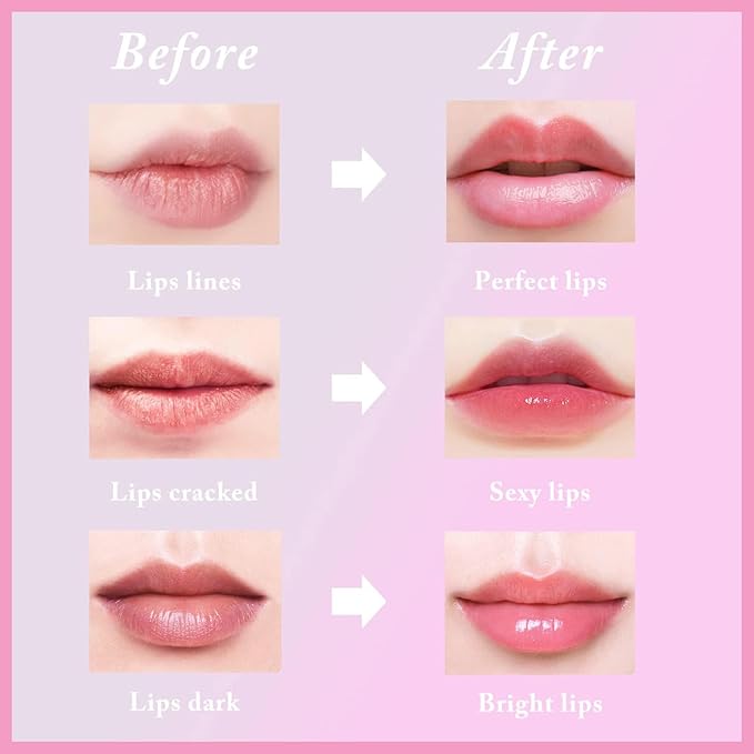 1 PCS Bee Lip Balm Lip Mask Honey Pot, Watermelon Moisturizing Sleeping Lip Mask Overnight with Sticks, Lip Balm Honey Pot Lip Balm Hydrating Prevention Dry and Crack Lip Scrubs Exfoliator