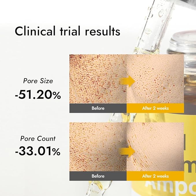 MIZON Real Vitamin C Ampoule, Pure Vitamin C, No Water Added,10 Ingredients, Nutrition, Face Moisturizer (1.01 fl oz)