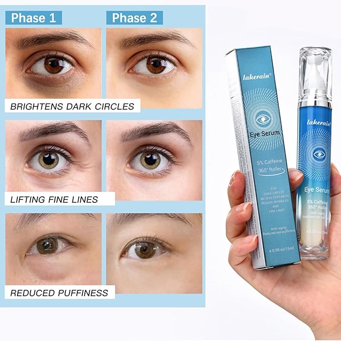 5% Caffeine Eye Serum,Caffeine Eye Cream with Massage Roller Ball,Under Eye Cream for Dark Circles,Puffiness,Under Eye Bags,Moisturizing Cream Eye Bags Fine Lines Wrinkle Treatment for Women and Men