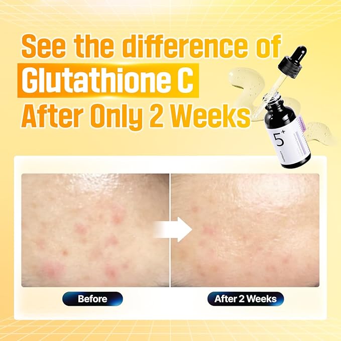 numbuzin No.5 Serum | Tranexamic Acid 4%, Niacinamide 5%, Glutathione, Vitamin C | Vitamin Concentrated Serum | Hyperpigmentation| Suitable for Sensitive Skin, Korean Skincare | 1.01 fl. oz.