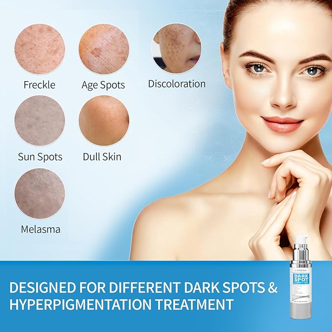 Dark Spot Remover for Face,Dark Spot Corrector, Dark Spot Serum for Sun Spots, Age Spots, Brown Spots,Acne Scars,Melasma Brown Spot -Advanced Formula with Niacinamide Retinol for Women (1.0 Fl Oz)