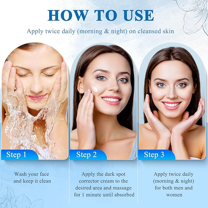 Dark Spot Remover for Face and Body, Dark Spot Corrector, Age Spot Sun Spot Freckles Dark Spot Remover, Melasma Treatment for Face, Advanced Skin Care Cream for Women and Men (1.7 Fl Oz)