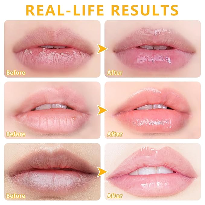 5 PCS Bee Balm Lip Balm Lip Mask Honey Pot, Lip Mask Propolis Moisturizing Lip Balm, Hydrating Prevention Dry and Cracked Lip Scrubs Exfoliator Lip Care (Strawberry&Watermelon&Honey&Apple Lime&Cherry)