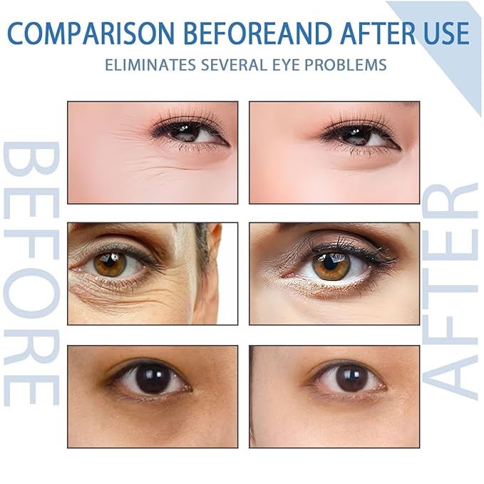 Peptide Depuffing Eye Serum, Himeye Peptide Eye Serum, Men's Caffeine Eye Serum, Men's Collagen Anti-Aging Eye Cream for Wrinkles, 0.5 Ounce (Pack of 2)