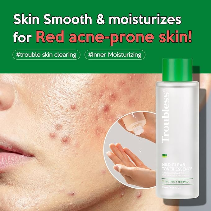 Troubless Mild Clear Toner Essence - Tea Tree Facial Toner for All Skin Types | Hydrating Skin Toner, Daily Skin Care (6.76 fl oz)