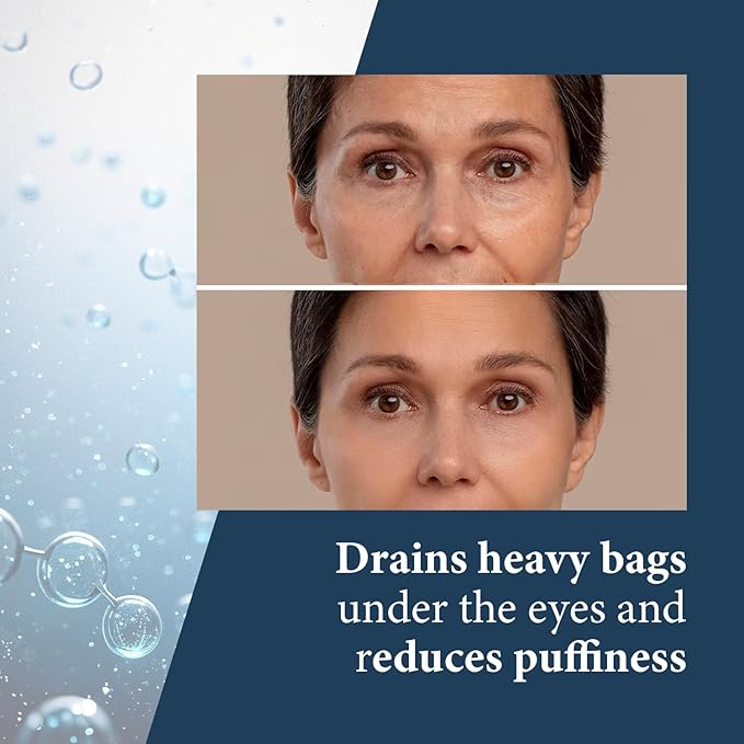 Elite Serum Rx - Anti Aging Under Eye Serum for Dark Circles and Puffiness with 8 Patented Peptides - Extra Strength Lifting and Firming Treatment for Wrinkle Repair and Eye Bag Removal