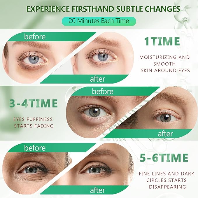 60 Pcs Green Under Eye Patches with 5 Pieces Travel 24K Gold Eye Mask, 30 Pairs Undereye Mask for Dark Circles Puffy Eye Treatment, Collagen Gel Pads Hydrating for Eye Bag Puffiness Wrinkle