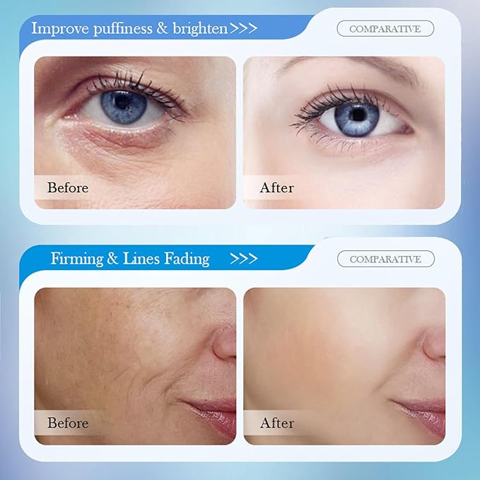 8D Hyaluronic Acid Face Care Set, Hydrating Skin Care Set Moisturize Skin, Smooth Fine Lines, Improves Skin Elasticity, Anti-Aging Skin Care Set with Cleanser,Eye Cream,Face Cream,Serum,Mask