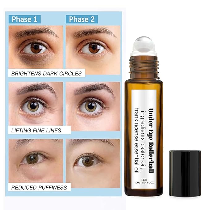 Time Eraser Rollerball Castor Oil and Frankincense, Time Eraser Rollerball, Castor Oil and Frankincense Eye Roller for Reducing Dark Circles and Bags Under Eyes