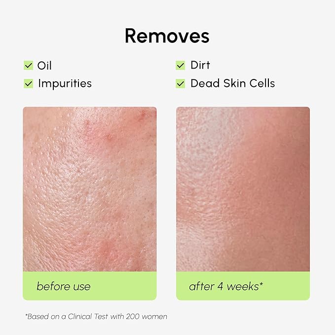 MAREE Exfoliating Toner with Salicylic Acid – AHA BHA Exfoliant & Face Exfoliator Pore Cleaner – BHA Liquid Exfoliant – Sebum Dead Skin Care Remover for Face – Exfoliante Para la Cara Acido Salicilico