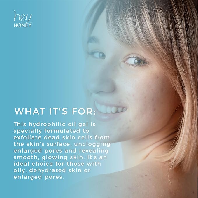 Hey Honey Skincare Be Clear - Acne Control Deep Pores Cleansing Gel | Propolis, Green Tea Oil, Camellia | Exfoliates, Unclogs Pores, Balances Oil Production | Fast Acting & Long Lasting | 2.7 Oz