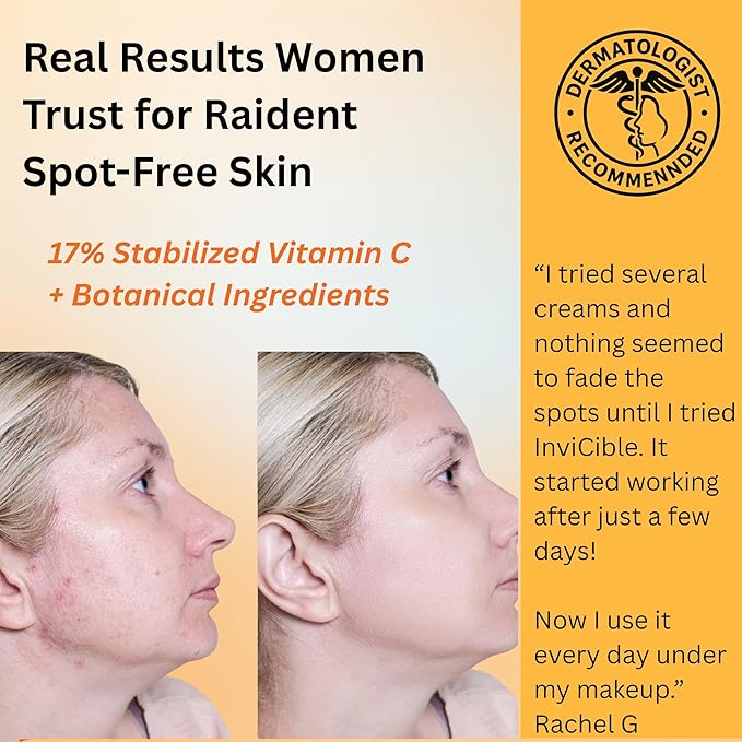 5 in 1 Primer For Face Before Makeup | 17% Vitamin C | All Day Grip | Dark Spot Corrector | Silky Matt Finish | Chemical Free | Vegan | All Skin Types | Made in America | 1fl oz