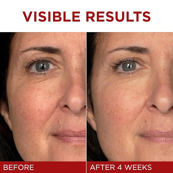 L'Oreal Paris Revitalift Triple Power Anti-Aging Face Moisturizer, Fragrance Free, Pro Retinol, Hyaluronic Acid & Vitamin C to Reduce Wrinkles, Firm & Brighten Skin, 2.55 Oz