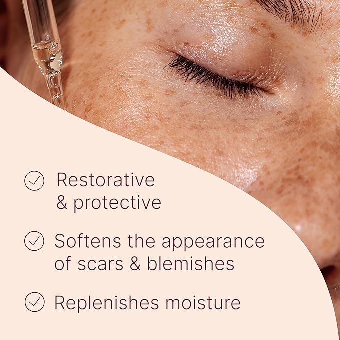Plant Therapy Restorative Facial Oil with Rosehip & Arnica 1 oz Natural Ingredients, Restore & Protect Skin, Antioxidants and Fatty Acids, Deeply Nourish Skin
